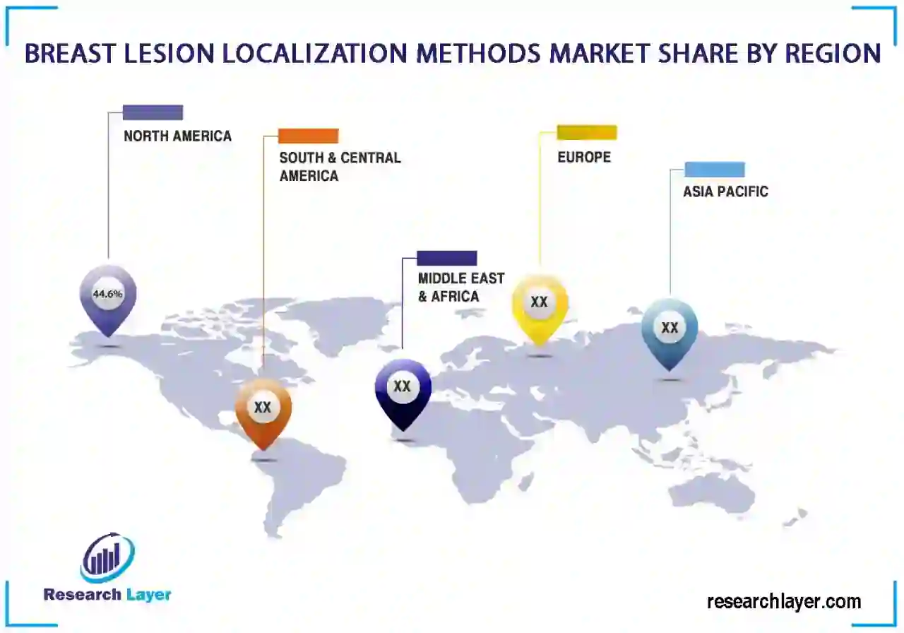 Breast Lesion Localization Methods Market